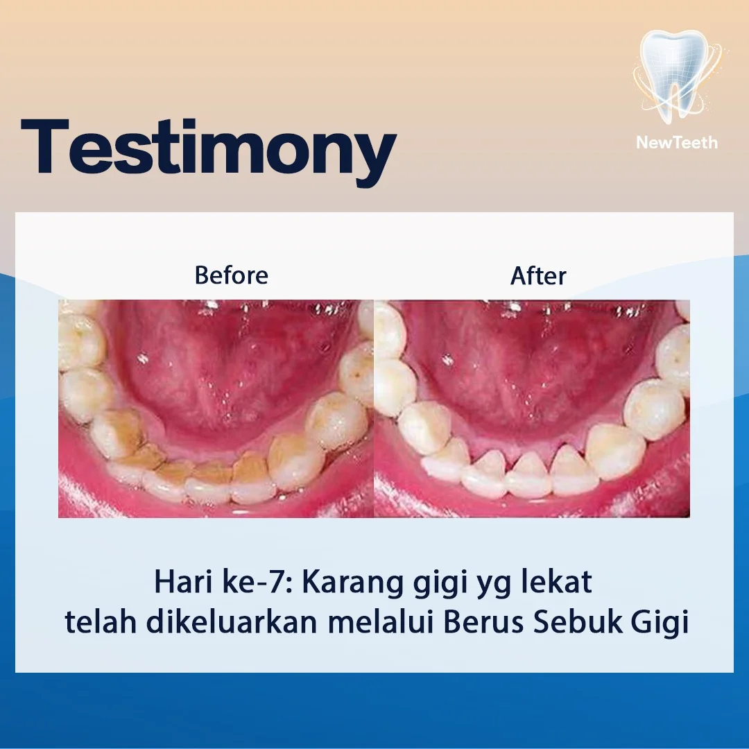 new-teeth-testimony-1.webp