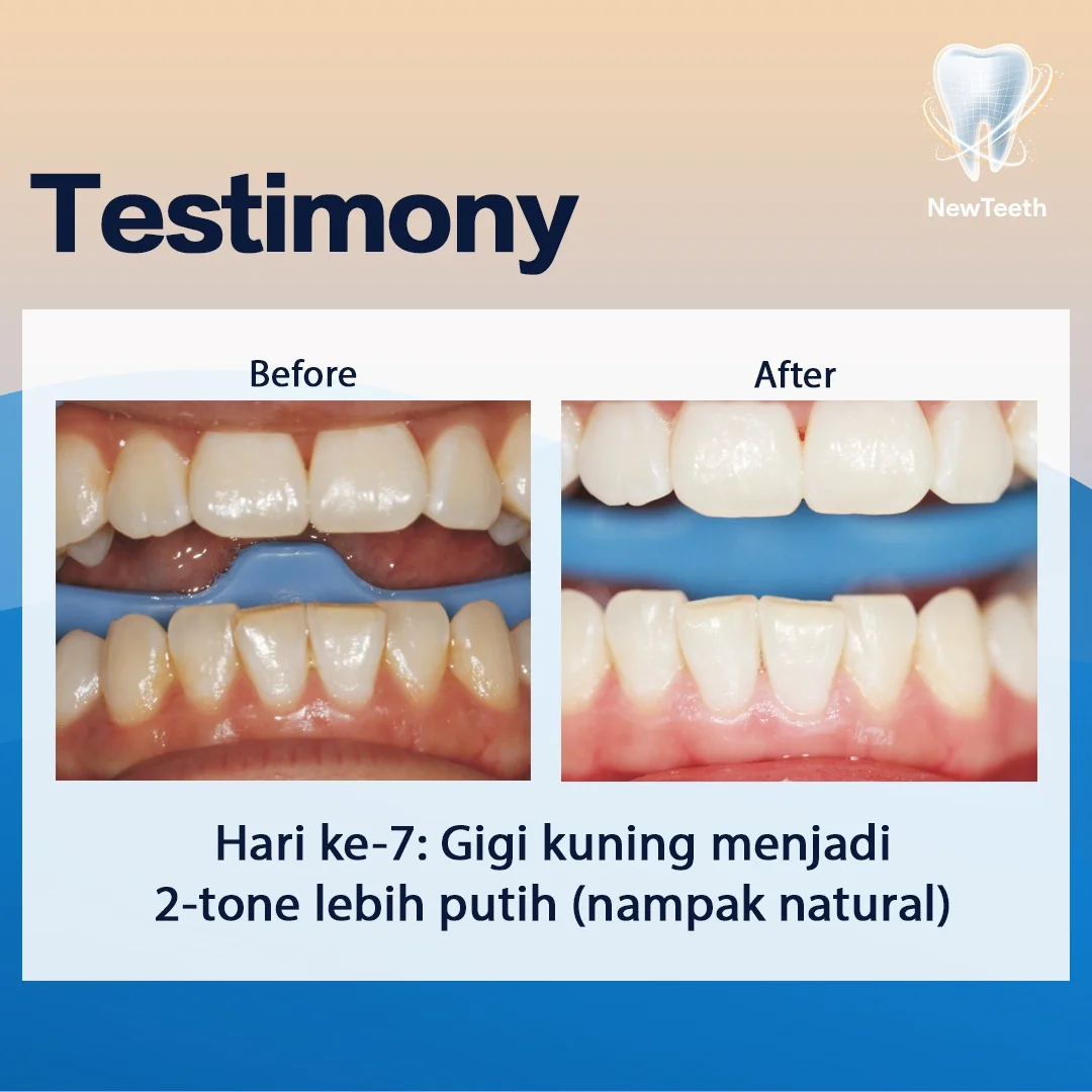 new-teeth-testimony-10.webp