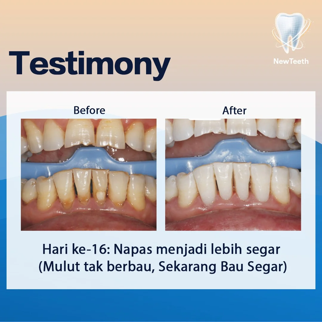 new-teeth-testimony-11.webp