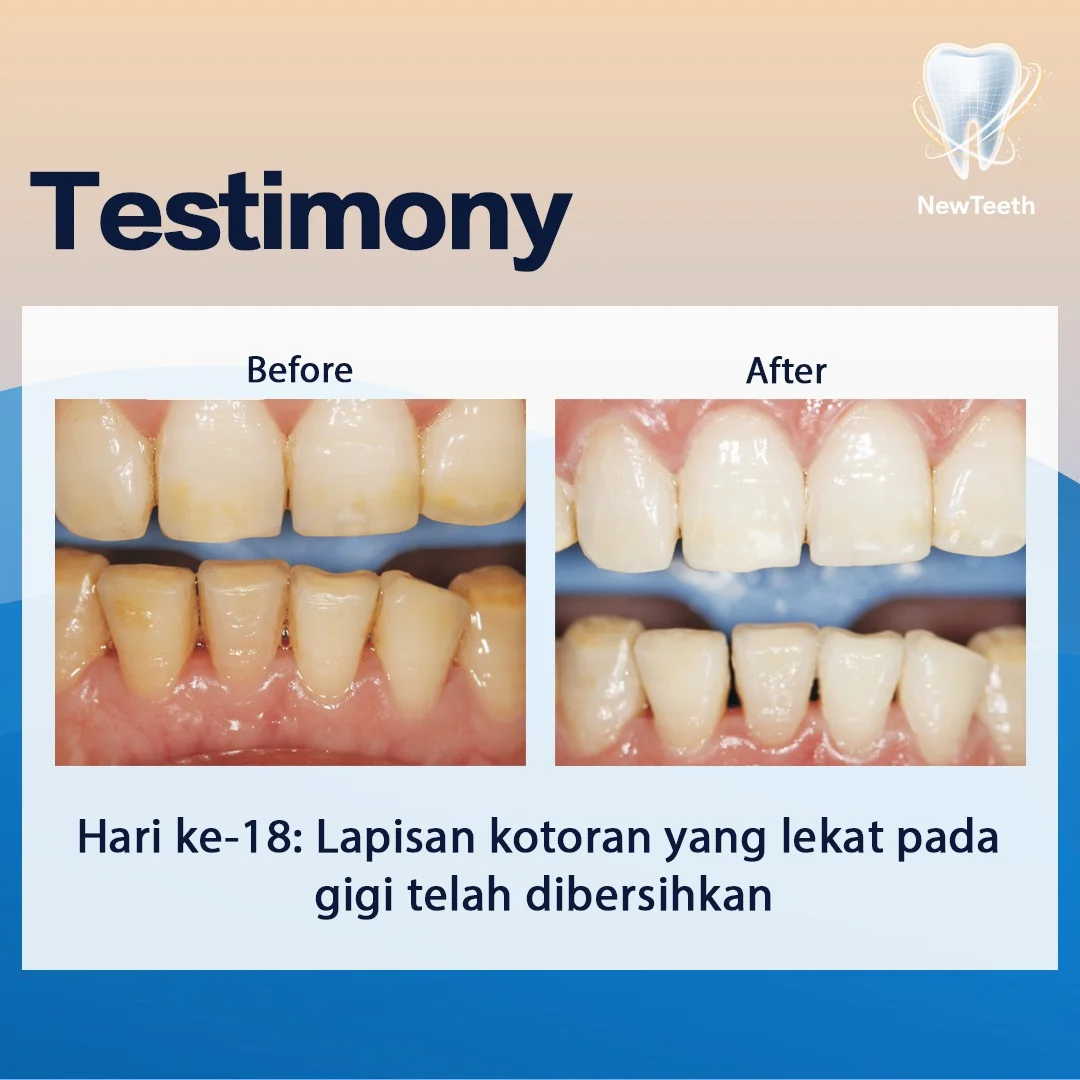 new-teeth-testimony-12.webp