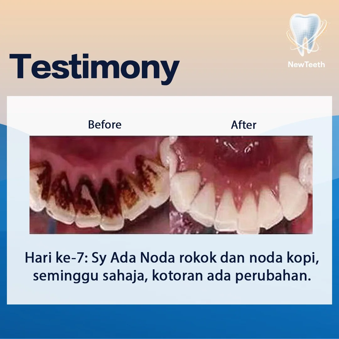 new-teeth-testimony-2.webp