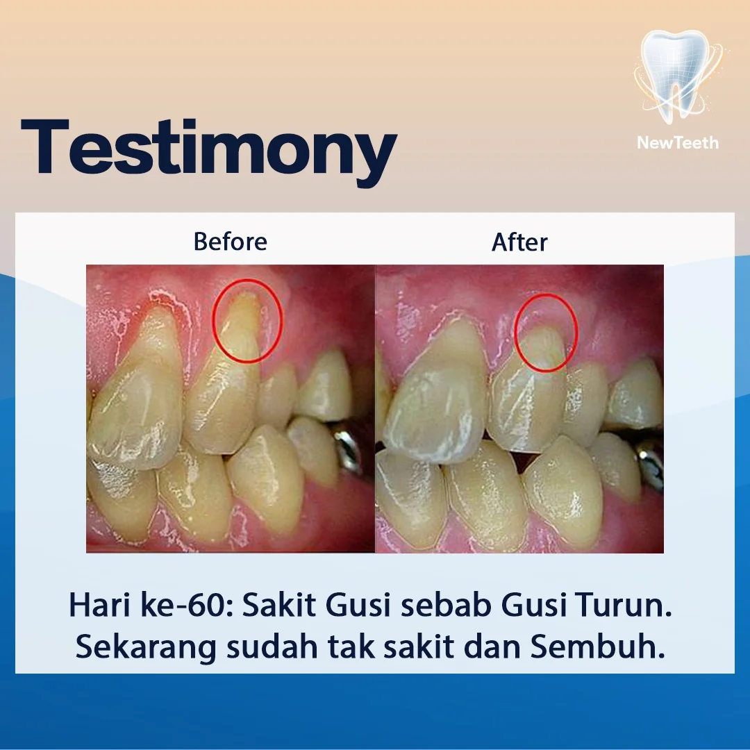 new-teeth-testimony-3.webp