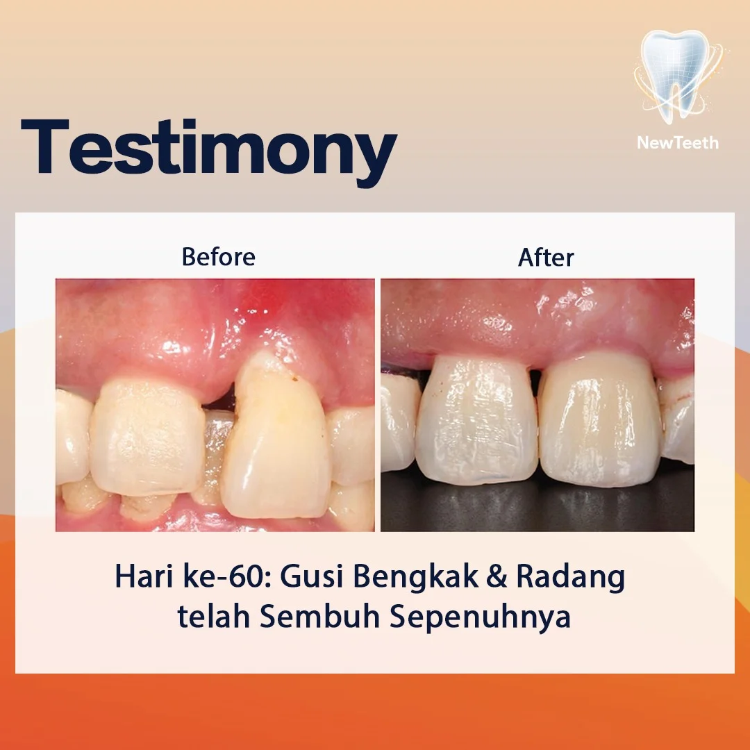 new-teeth-testimony-4.webp