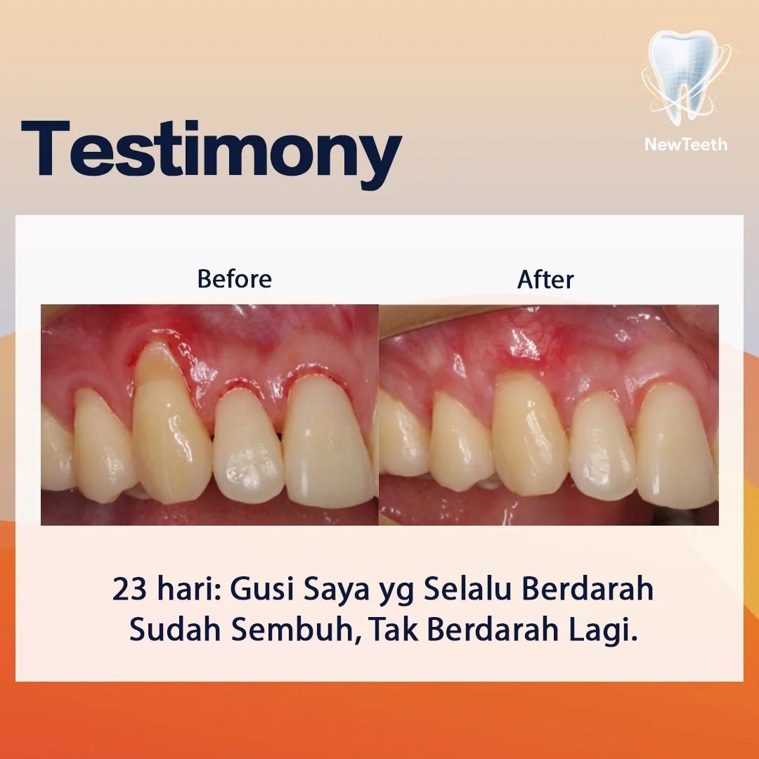 new-teeth-testimony-5.webp