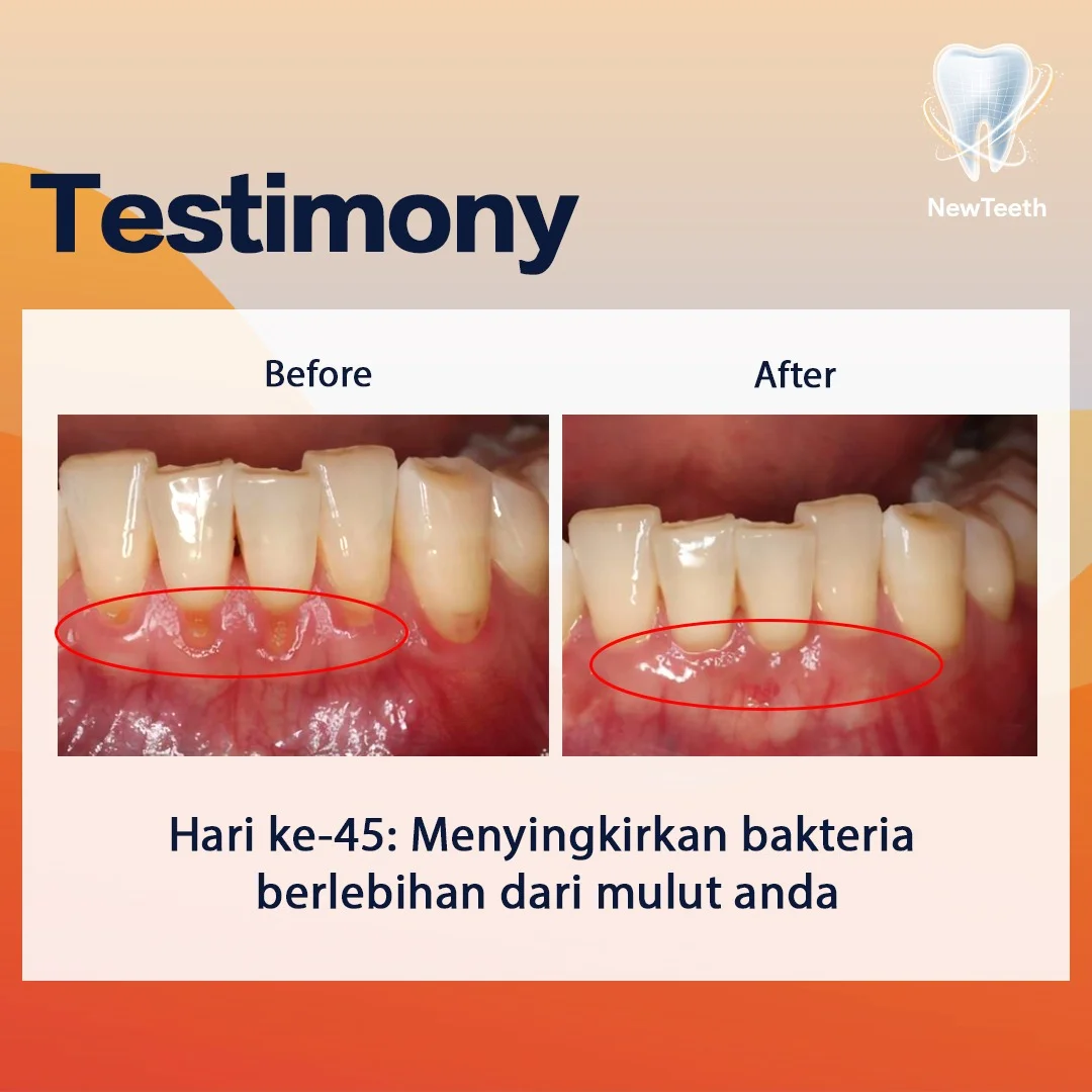 new-teeth-testimony-6.webp