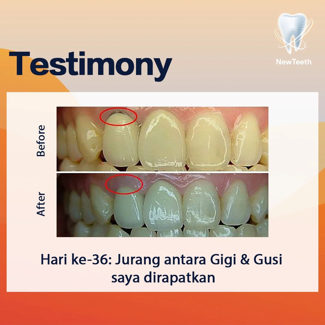 new-teeth-testimony-7.webp