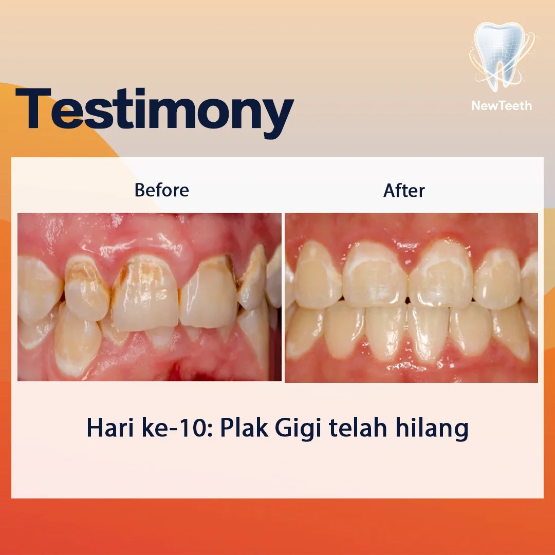 new-teeth-testimony-8.webp