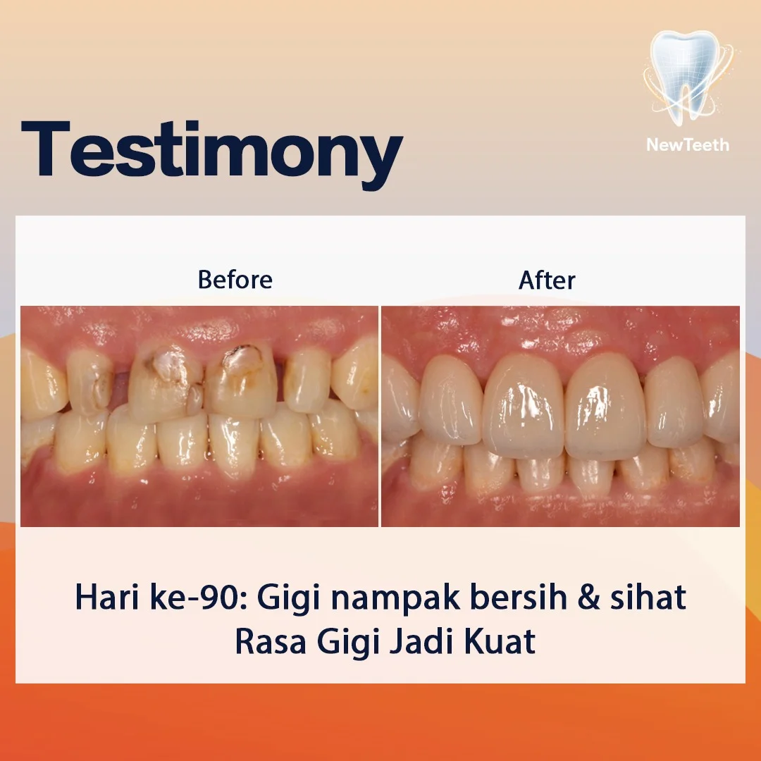 new-teeth-testimony-9.webp